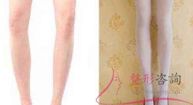 1409384370 1409384370