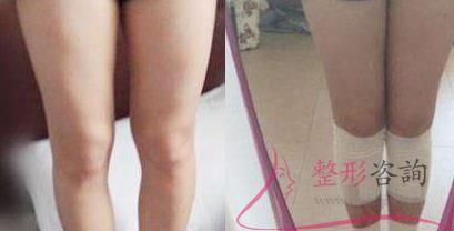 1409466393 1409466393