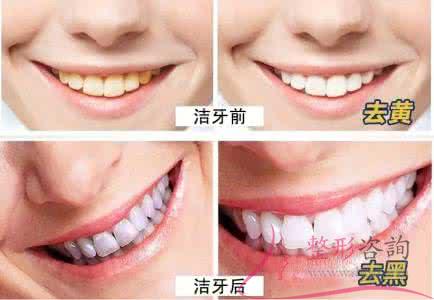 1441397468 1441397468