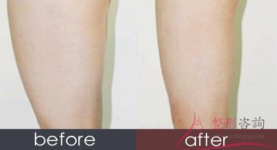 1507369501 1507369501