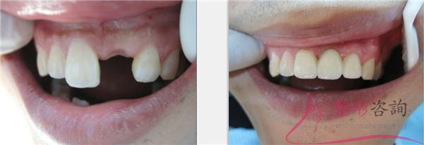 1509168706 1509168706