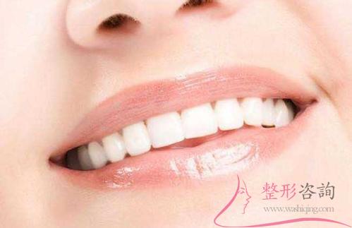 1521486118 1521486118