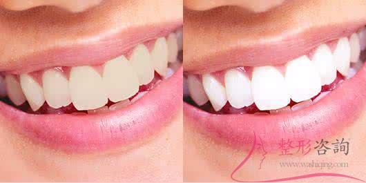 1529465771 1529465771