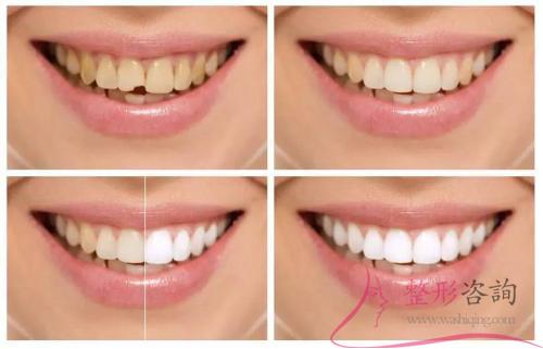 1531212502 1531212502