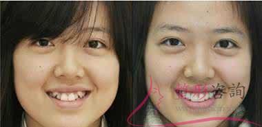 1554418454 1554418454