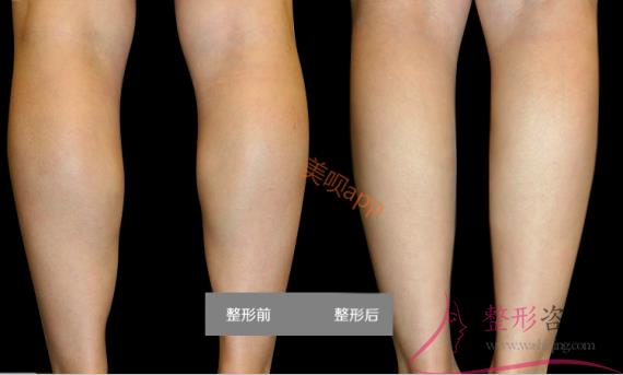 1645283117 1645283117