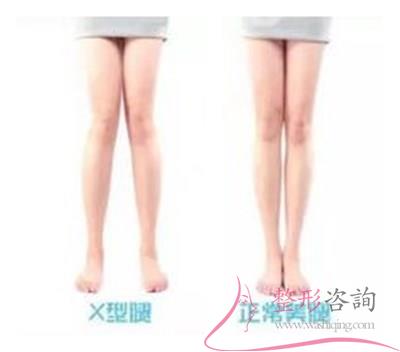 1745298386 1745298386