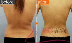 1829183538 1829183538