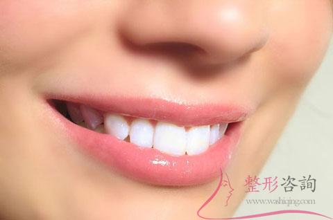 1902101173 1902101173