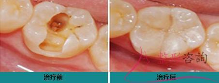 2134455990 2134455990