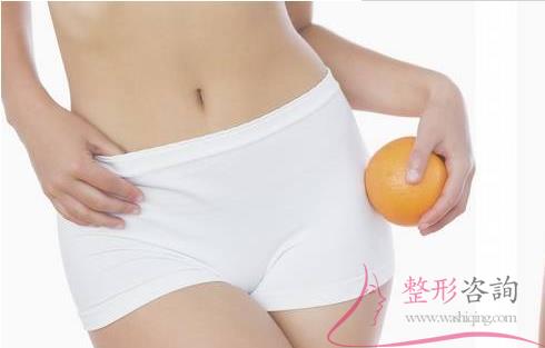 2155295308 2155295308