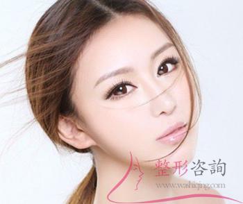 1336322740 1336322740