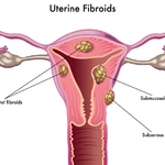 OL完美體型只需三個動作