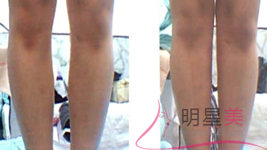 1625459576 1625459576