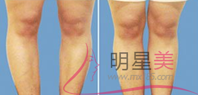 1625599323 1625599323