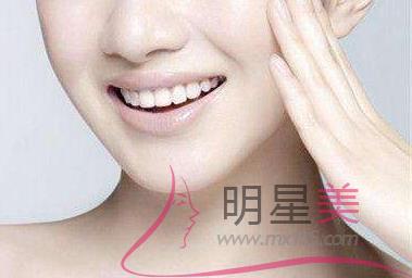 下頜骨后縮矯正器圖片