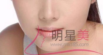 臉上下顎兩邊長痘痘用什么藥