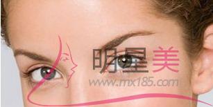 膠原蛋白填充額頭可以嗎