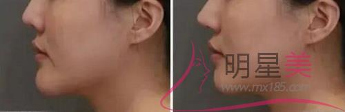 額頭長疙瘩是怎么了