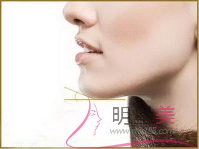 山東豐胸自體脂肪