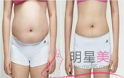 注射<a href=http://www.f3bb6.cn/listinfo-631-0.html target=_blank class=infotextkey>瘦臉</a>手術醫院