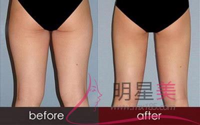 怎么坐著瘦肌肉腿