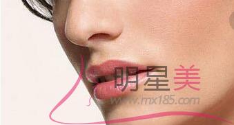 怎么緩解面部衰老