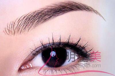 惠州提眉<a href=http://www.f3bb6.cn/listinfo-655-0.html target=_blank class=infotextkey>切眉</a>手術