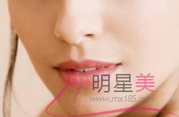 脂肪填充太陽凹陷圖片