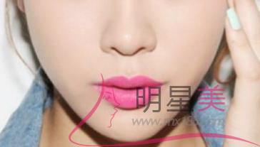 懷孕期間怎么才能避免長斑