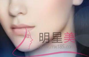 <a href=http://www.f3bb6.cn/listinfo-690-0.html target=_blank class=infotextkey>自體脂肪填充</a>有什么弊端