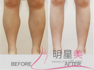 怎樣<a href=http://www.f3bb6.cn/listinfo-684-0.html target=_blank class=infotextkey>瘦大腿</a>小腿和臀部