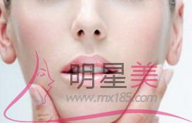 北京自體<a href=http://www.f3bb6.cn/listinfo-630-0.html target=_blank class=infotextkey>豐太陽(yáng)穴</a>