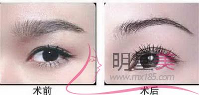 紋眉一個星期能不能敷面膜