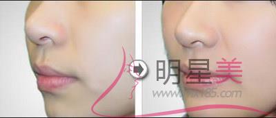 <a href=http://www.f3bb6.cn/listinfo-643-0.html target=_blank class=infotextkey>豐額頭</a>用什么材料