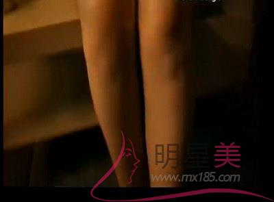 打瘦腿針明顯嗎