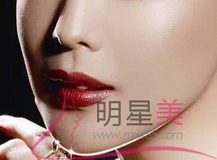 臉上的雀斑顏色加重是什么原因