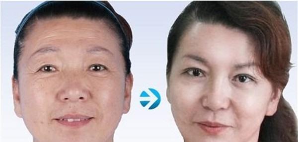 做<a href=http://www.f3bb6.cn/listinfo-731-0.html target=_blank class=infotextkey>玻尿酸</a><a href=http://www.f3bb6.cn/listinfo-765-0.html target=_blank class=infotextkey>去抬頭紋</a>價(jià)格