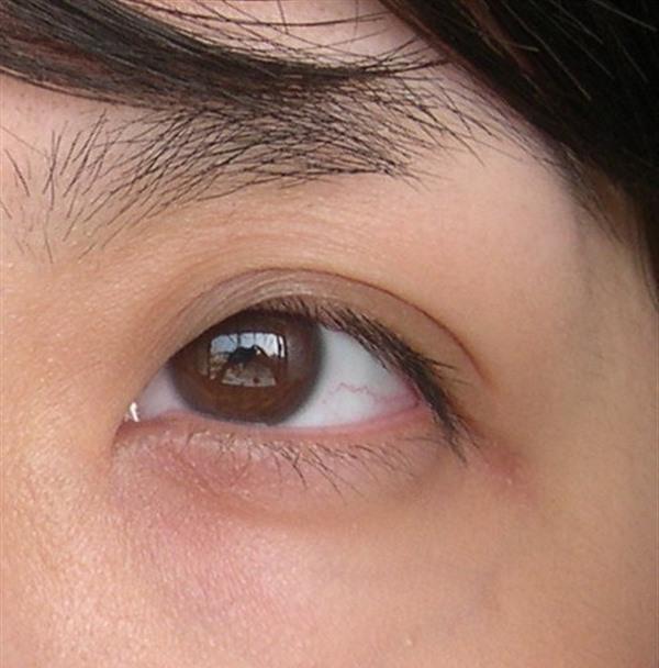 <a href=http://www.f3bb6.cn/listinfo-782-0.html target=_blank class=infotextkey>去眼角細紋</a>失敗修復價格