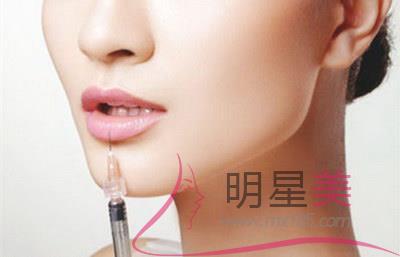 四十歲女人臉有皺紋