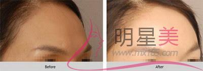 拍照下巴歪怎么回事