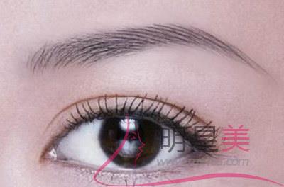 無痕提眉多久恢復