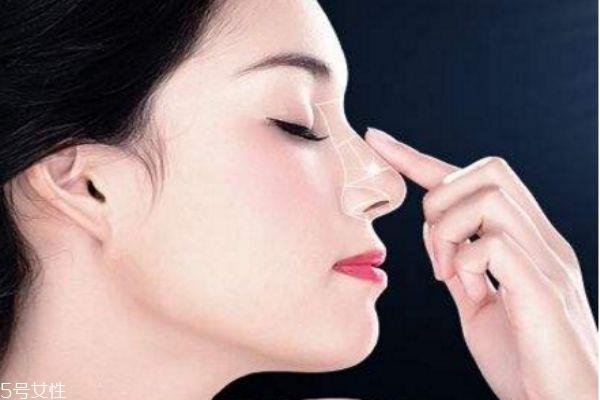 <a href=http://www.f3bb6.cn/listinfo-737-0.html target=_blank class=infotextkey>隆鼻</a>修復(fù)安全嗎 鼻修復(fù)失敗案例