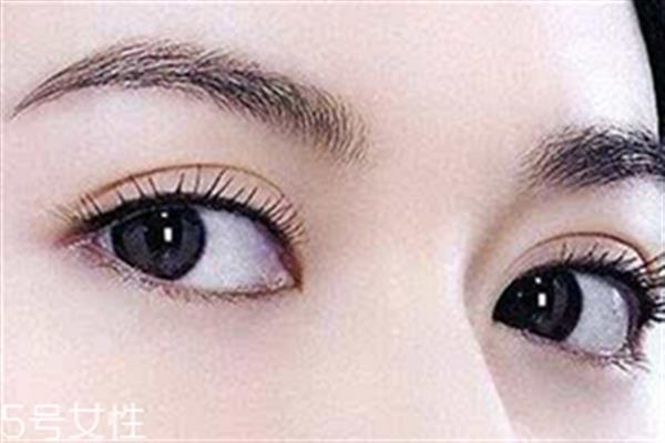 割<a href=http://www.f3bb6.cn/listinfo-724-0.html target=_blank class=infotextkey>雙眼皮</a>眼睛腫怎么辦?疤克可以預防疤痕增生