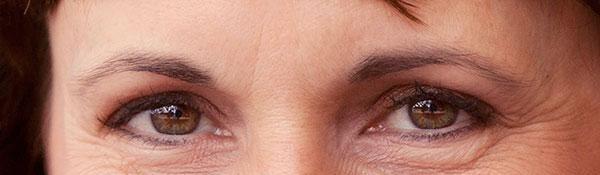 做膠原蛋白<a href=http://www.f3bb6.cn/listinfo-780-0.html target=_blank class=infotextkey>去魚尾紋</a>價格貴不貴