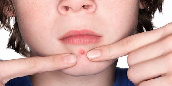 臉上怎么樣<a href=http://www.f3bb6.cn/listinfo-762-0.html target=_blank class=infotextkey>去脂肪粒</a>