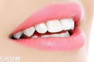 超聲波潔牙牙齒會(huì)變白嗎？超聲波潔牙心得