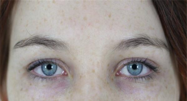 激光<a href=http://www.f3bb6.cn/listinfo-786-0.html target=_blank class=infotextkey>去黃褐斑</a>有危害嗎