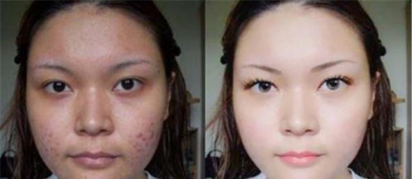 做激光<a href=http://www.f3bb6.cn/listinfo-797-0.html target=_blank class=infotextkey>去痘疤</a>價格多少錢