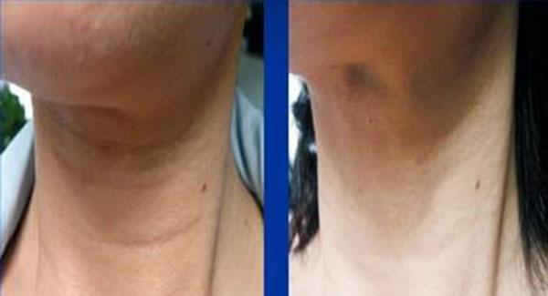 做<a href=http://www.f3bb6.cn/listinfo-785-0.html target=_blank class=infotextkey>去頸紋</a>副作用